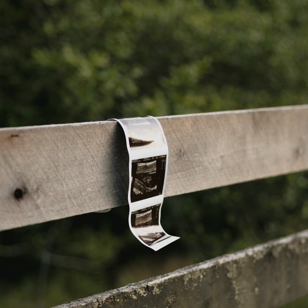 Photo shared by Mckenzie for their Babylist baby registry.