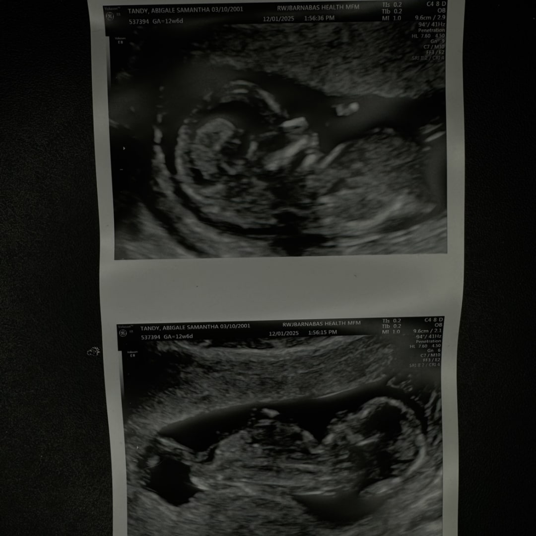 Photo shared by Abigale for their Babylist baby registry.