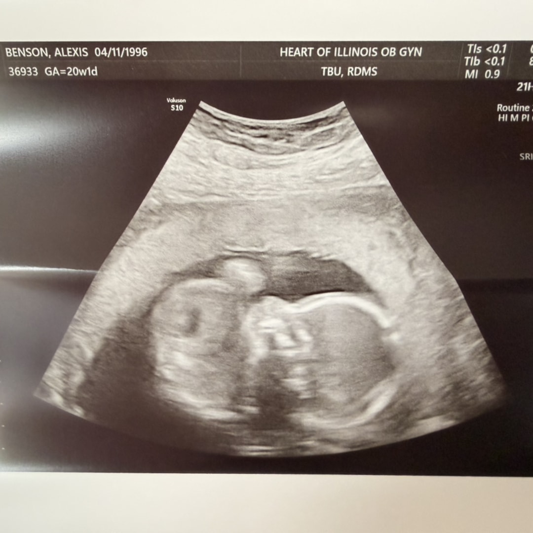 Photo shared by Alexis for their Babylist baby registry.
