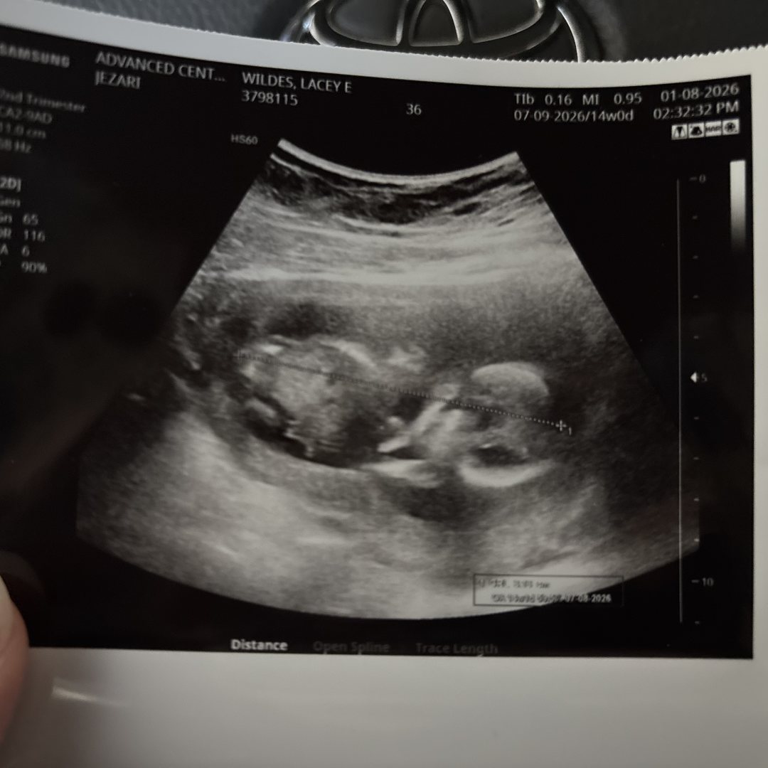 Photo shared by Lacey for their Babylist baby registry.