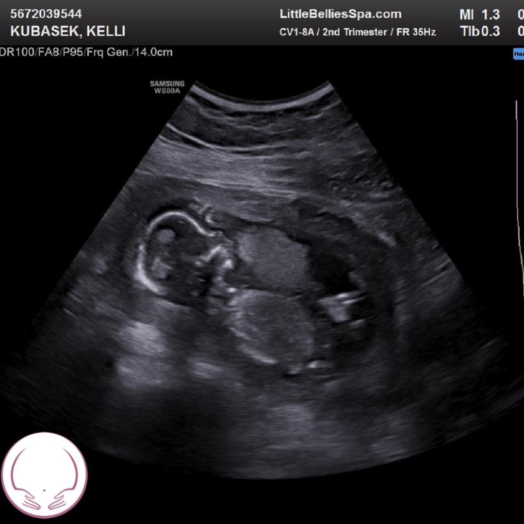 Photo shared by Kelli for their Babylist baby registry.