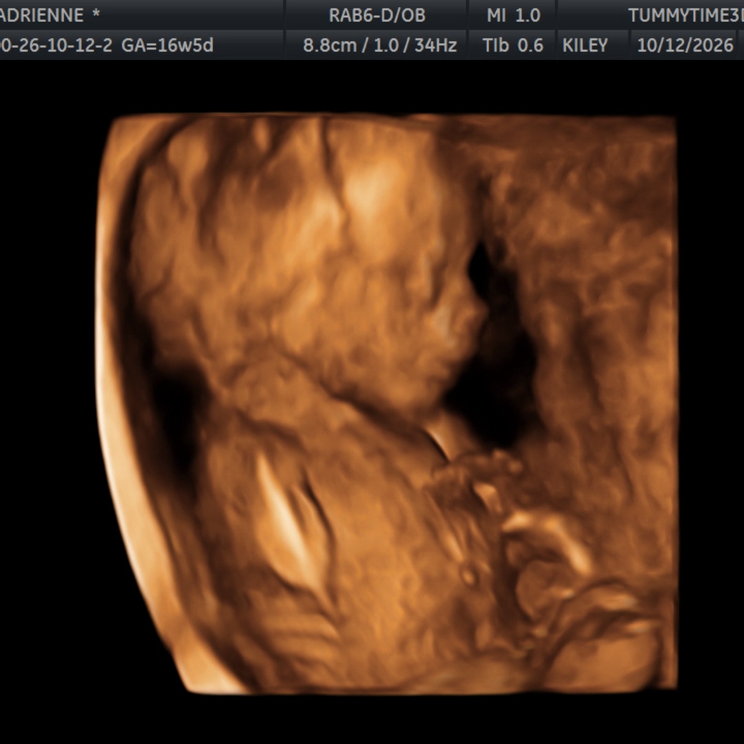 Photo shared by Adrienne for their Babylist baby registry.