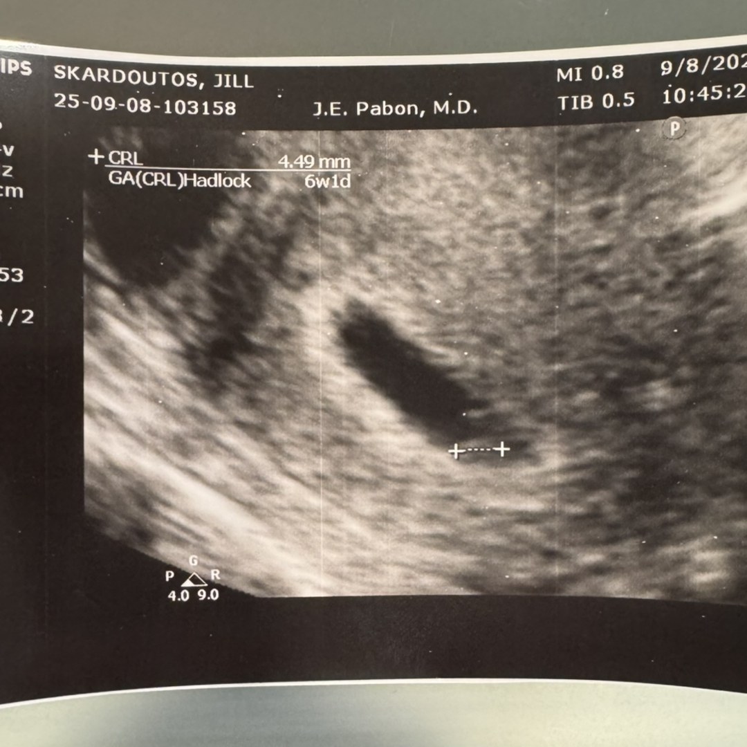 Photo shared by Jill for their Babylist baby registry.