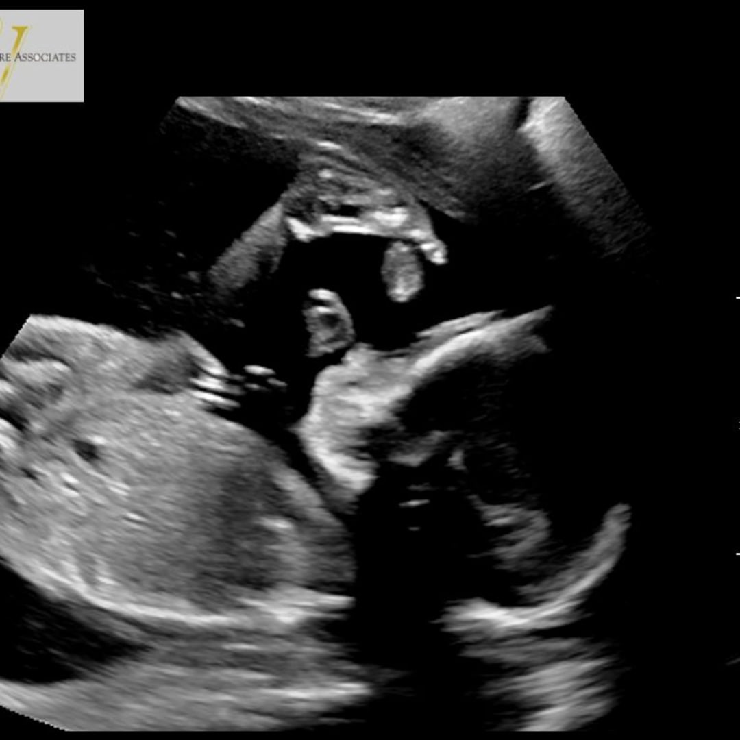 Photo shared by Alicia for their Babylist baby registry.