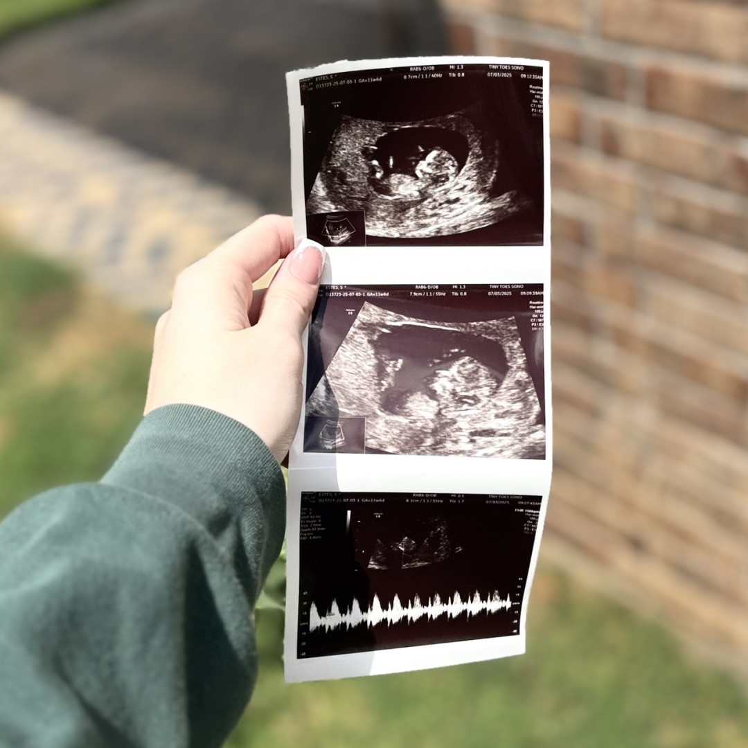 Photo shared by Samantha for their Babylist baby registry.