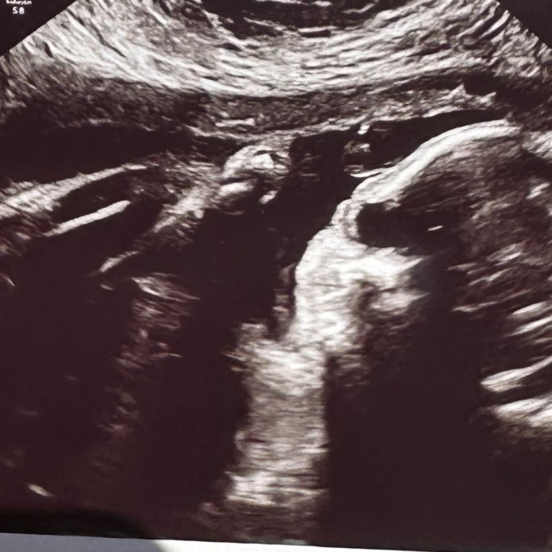 Photo shared by Vivianne for their Babylist baby registry.