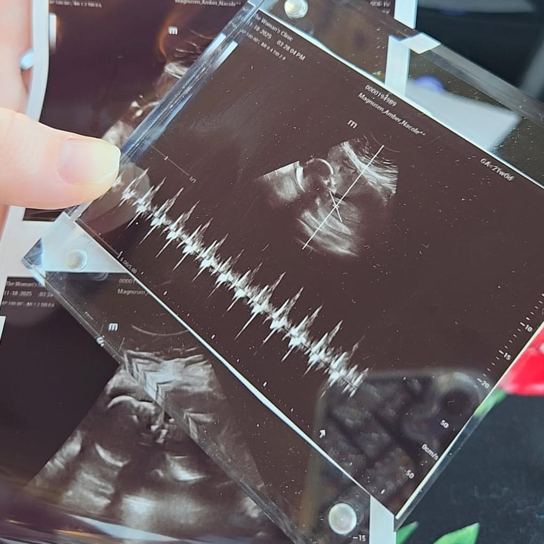 Photo shared by Amber for their Babylist baby registry.