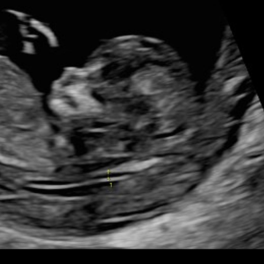 Photo shared by Ashley for their Babylist baby registry.