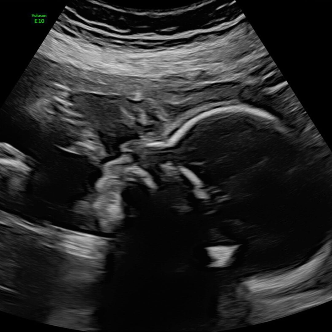 Photo shared by Katie for their Babylist baby registry.