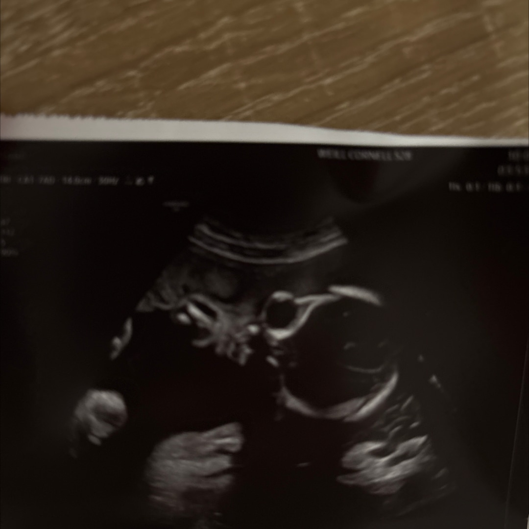 Photo shared by Michelle for their Babylist baby registry.