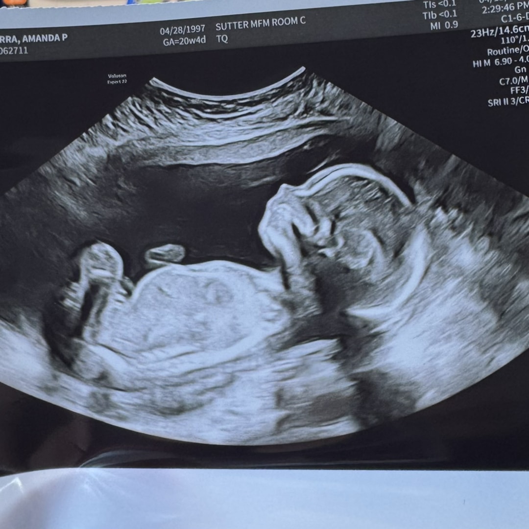 Photo shared by Amanda for their Babylist baby registry.