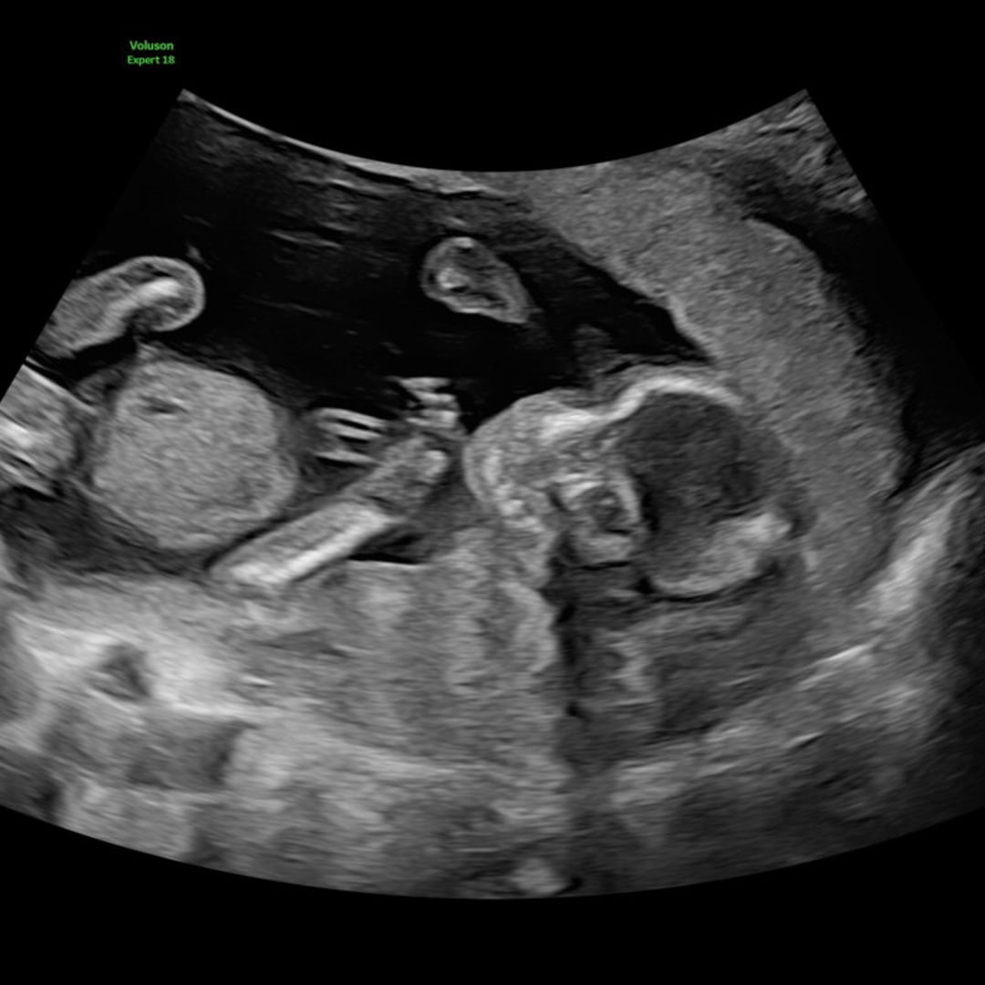Photo shared by Meg for their Babylist baby registry.