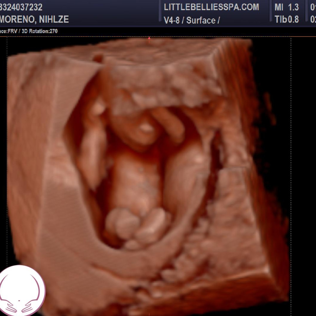 Photo shared by Nihlze for their Babylist baby registry.