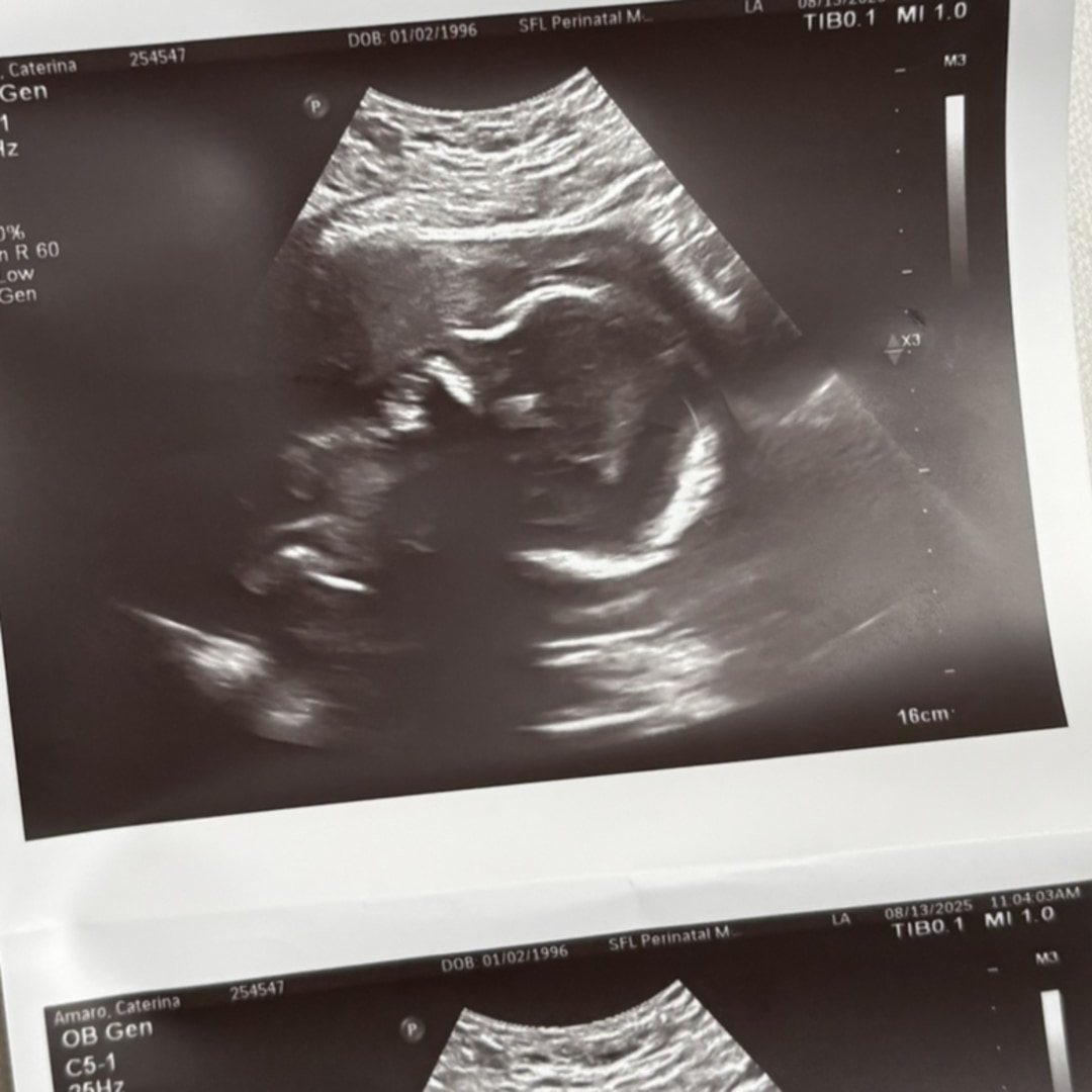 Photo shared by Caterina for their Babylist baby registry.