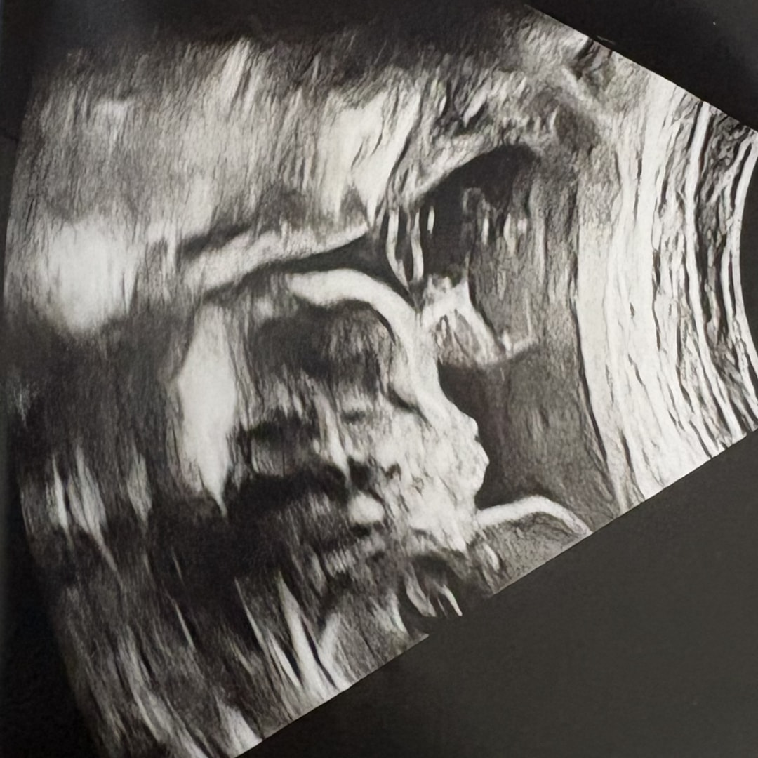 Photo shared by Leona for their Babylist baby registry.