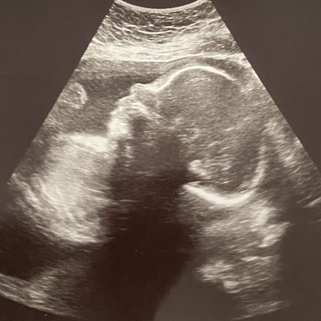 Photo shared by Jennifer for their Babylist baby registry.