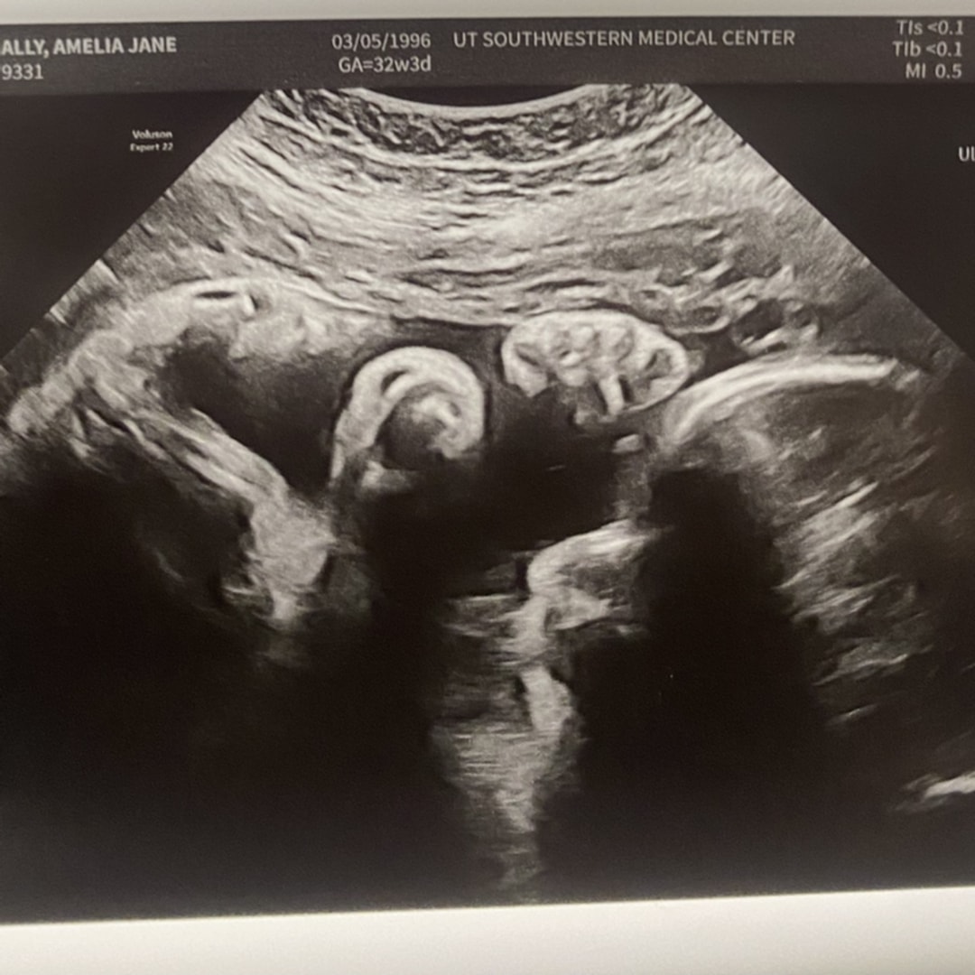 Photo shared by Amy for their Babylist baby registry.