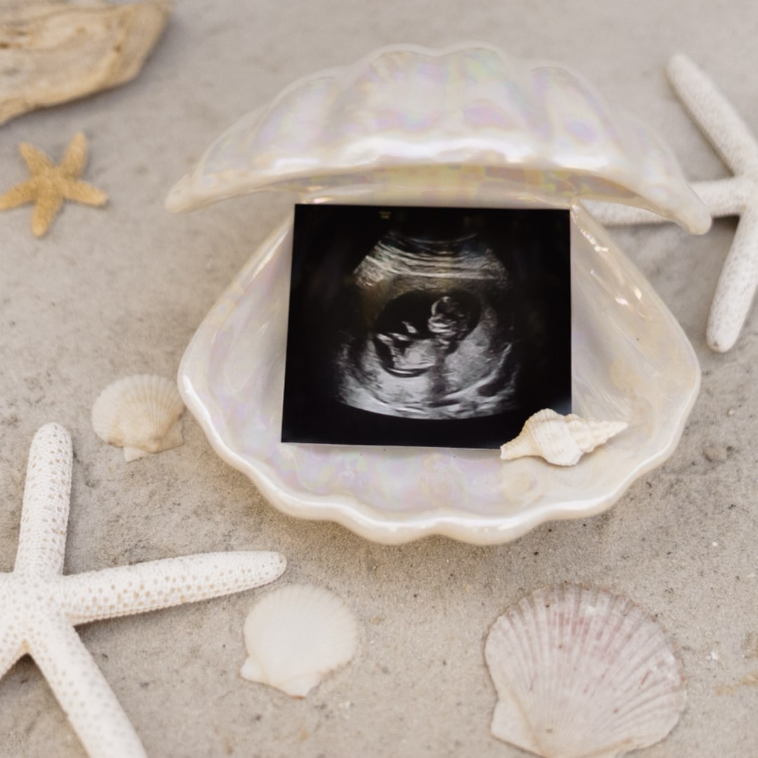 Photo shared by Sara for their Babylist baby registry.