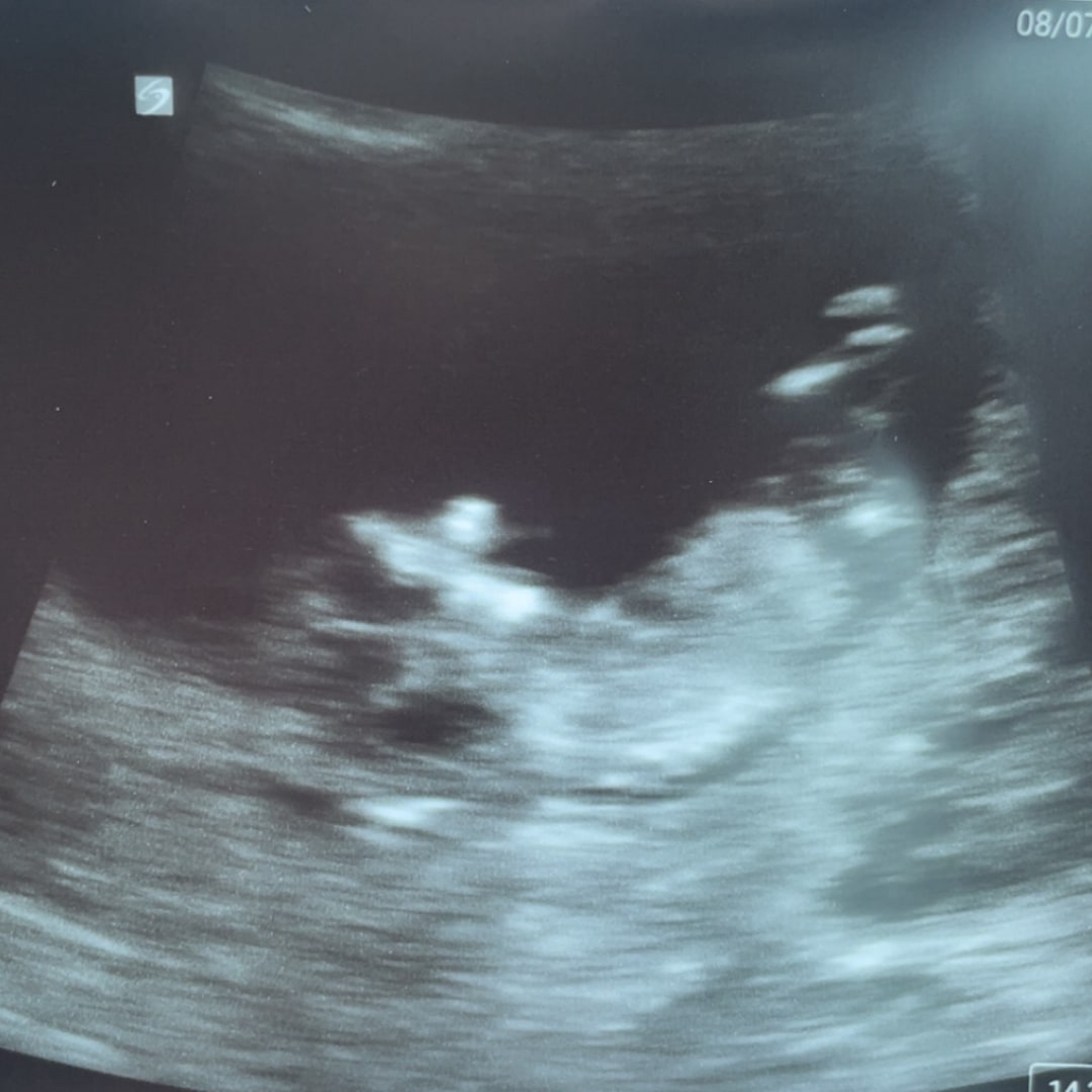 Photo shared by Anna for their Babylist baby registry.