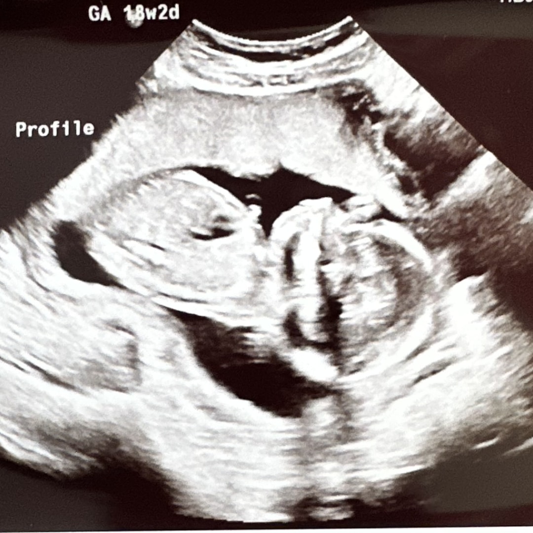 Photo shared by Kinley for their Babylist baby registry.
