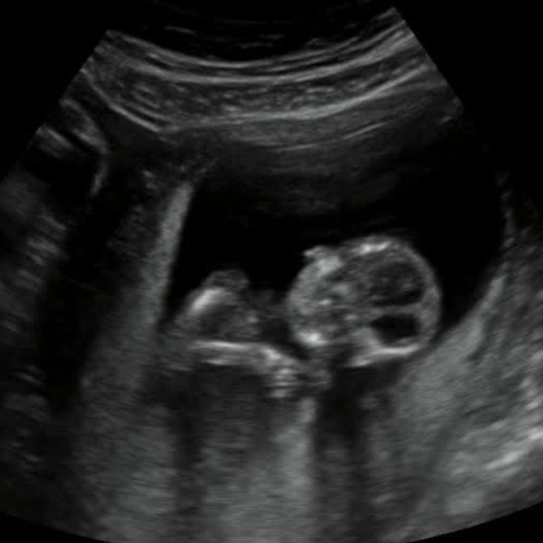 Photo shared by Dreanne for their Babylist baby registry.