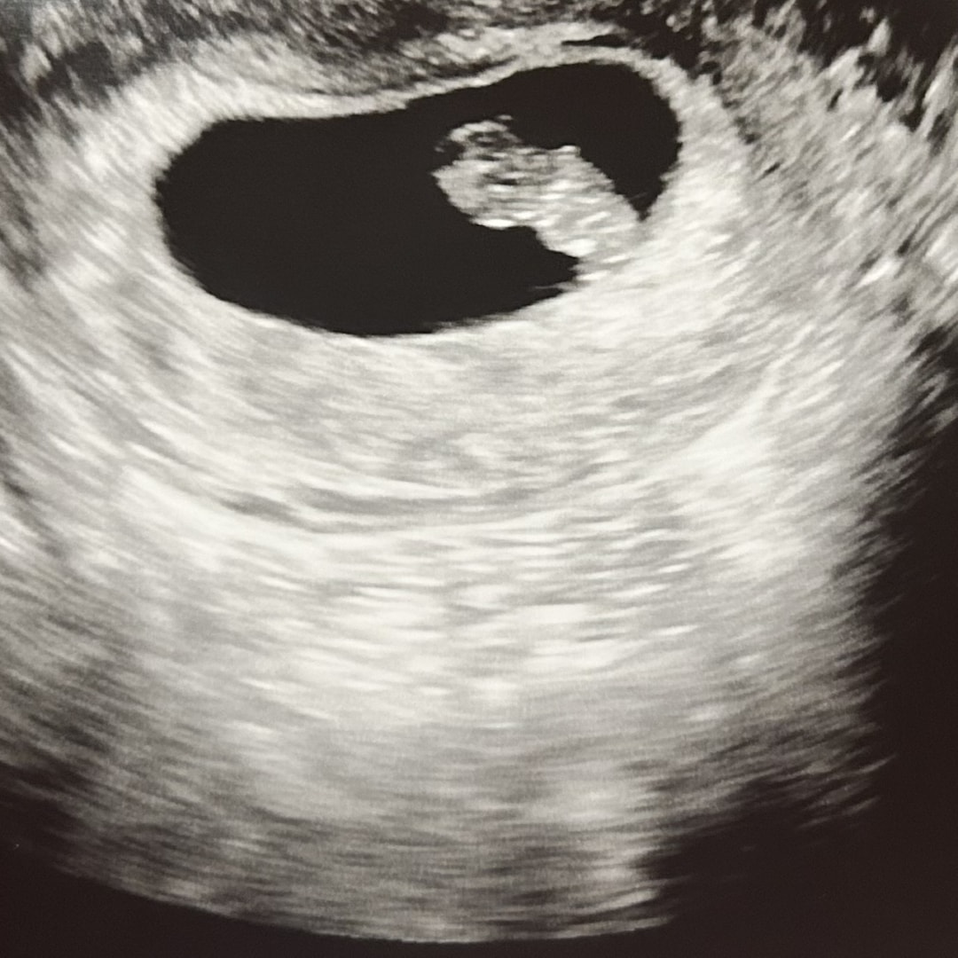 Photo shared by Linda for their Babylist baby registry.