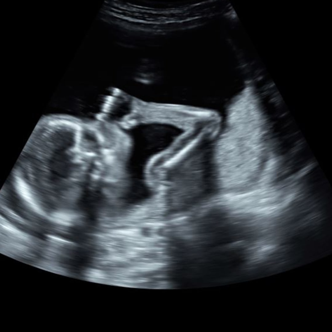 Photo shared by Darryl-Ann for their Babylist baby registry.