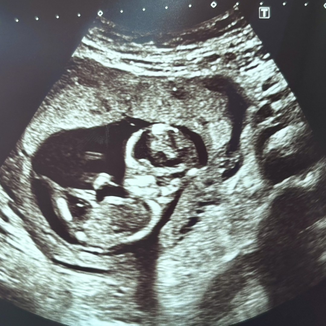 Photo shared by Trinity for their Babylist baby registry.