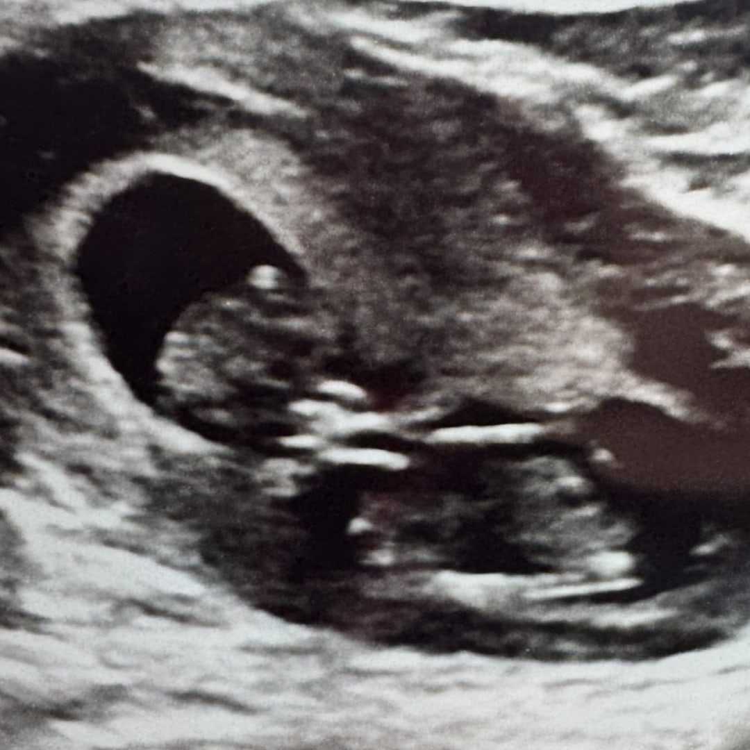Photo shared by Alexis for their Babylist baby registry.