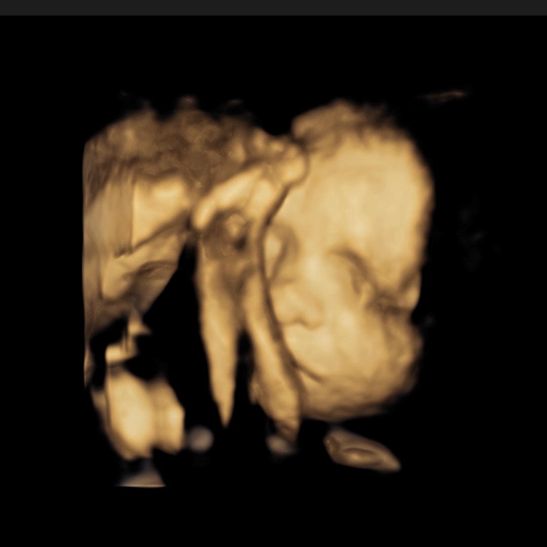 Photo shared by Xena for their Babylist baby registry.