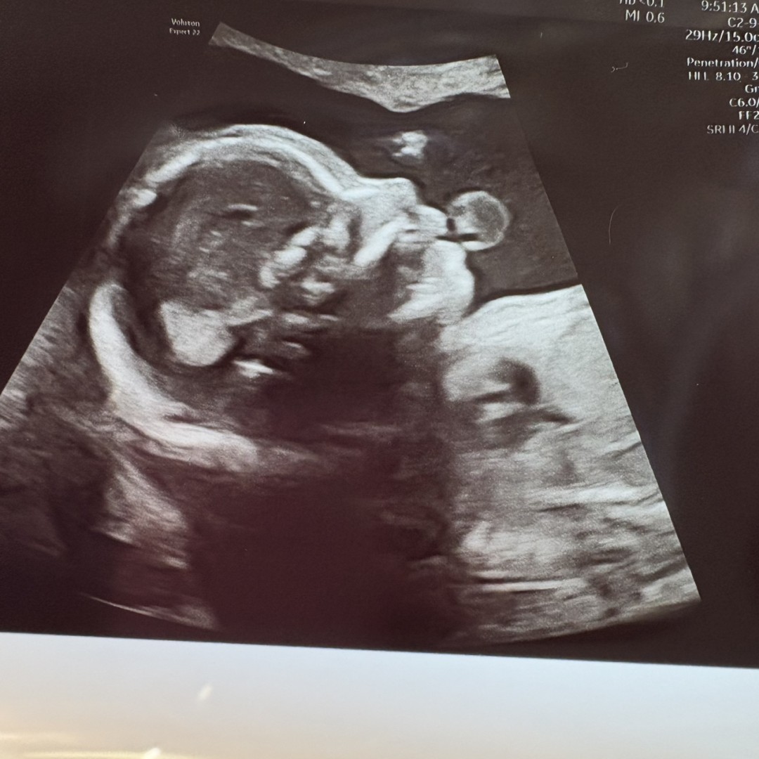 Photo shared by Ashlley for their Babylist baby registry.