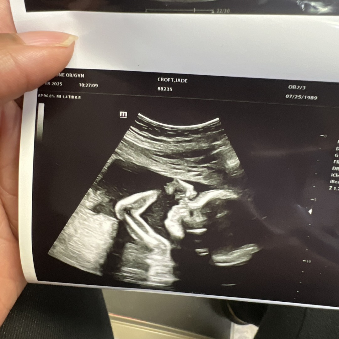 Photo shared by Jade for their Babylist baby registry.
