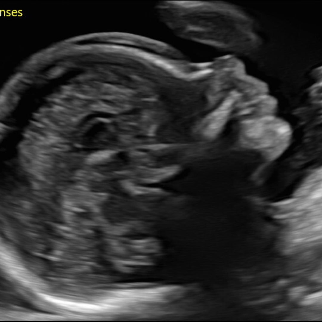 Photo shared by Jesse for their Babylist baby registry.