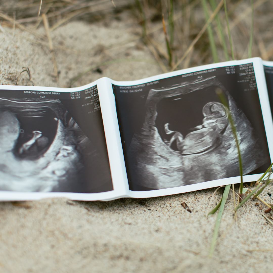 Photo shared by Courtney for their Babylist baby registry.