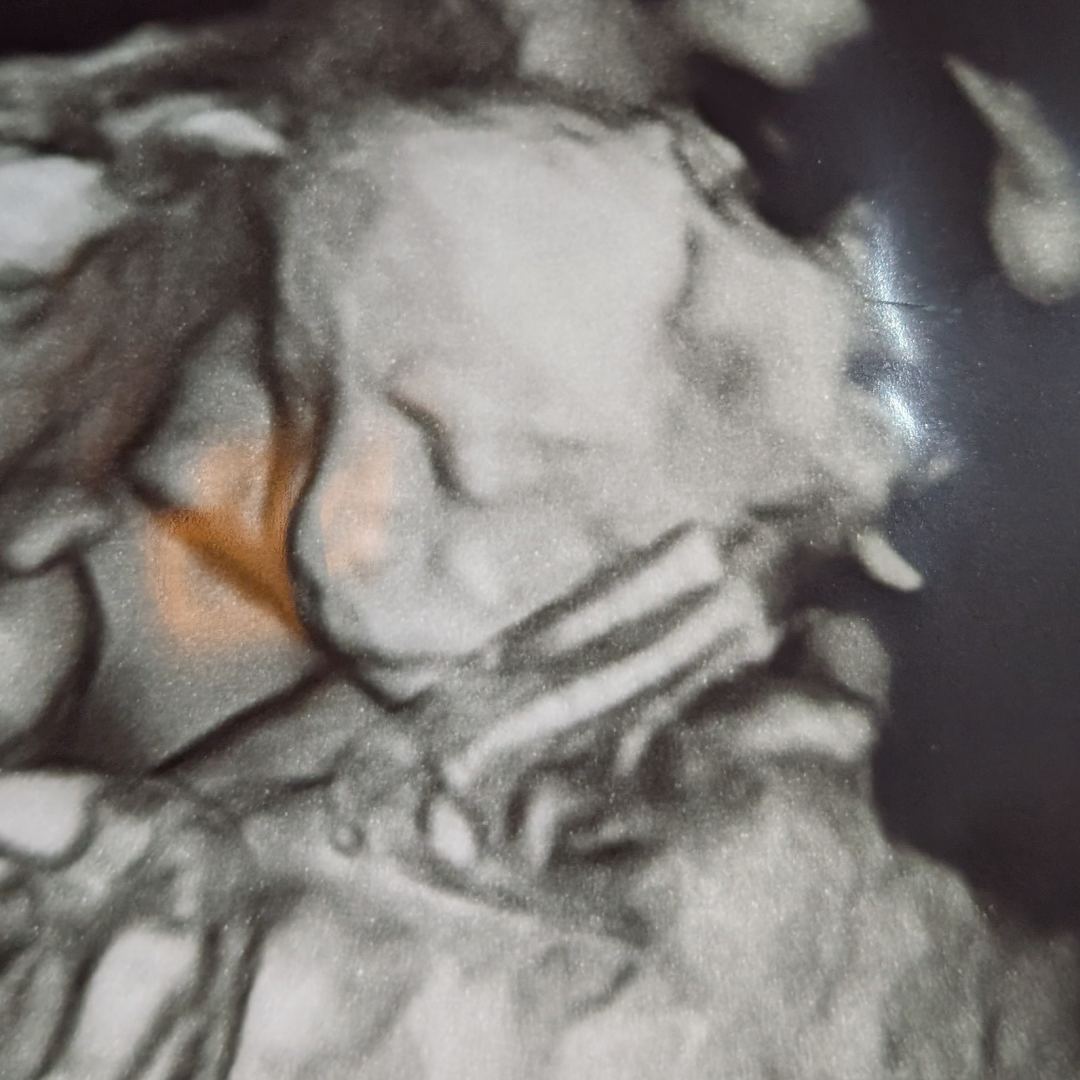 Photo shared by Caylee for their Babylist baby registry.