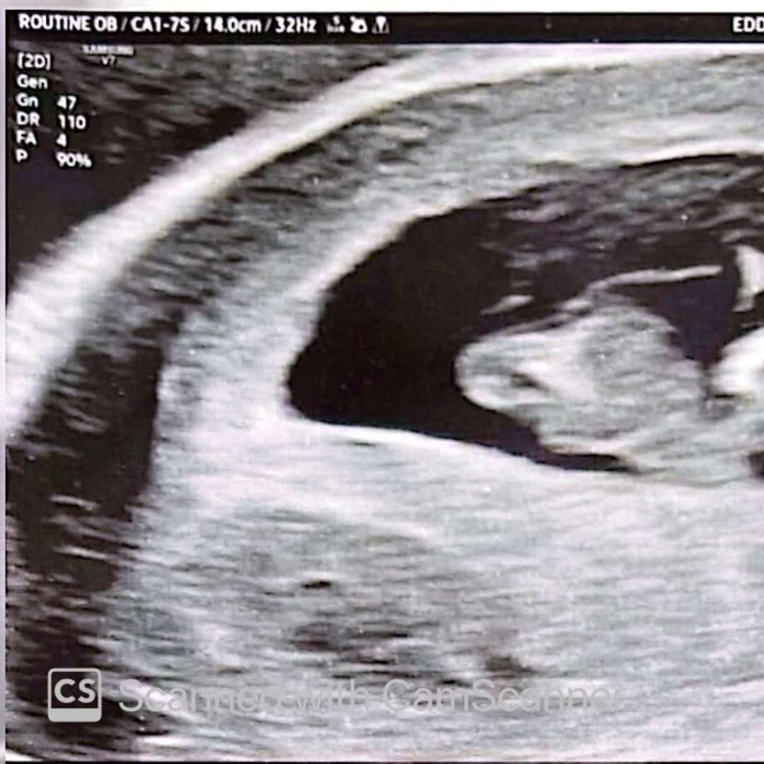 Photo shared by Abigail for their Babylist baby registry.