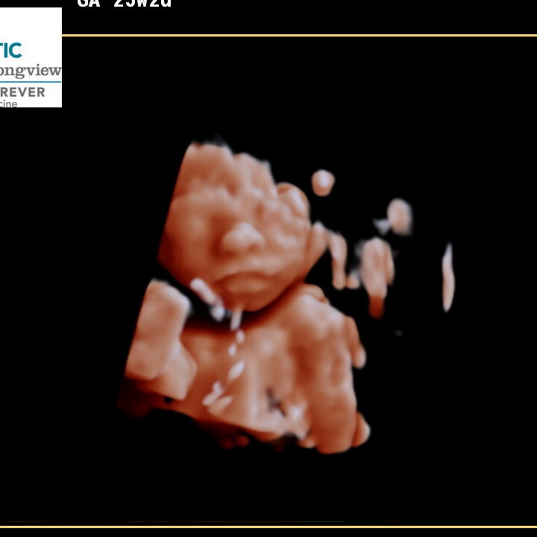 Photo shared by Haley for their Babylist baby registry.