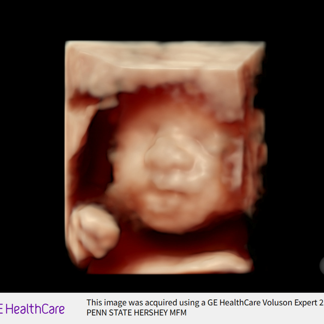 Photo shared by Alex for their Babylist baby registry.