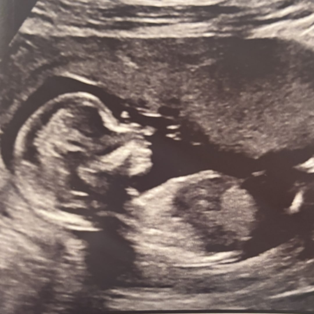 Photo shared by Gracie for their Babylist baby registry.