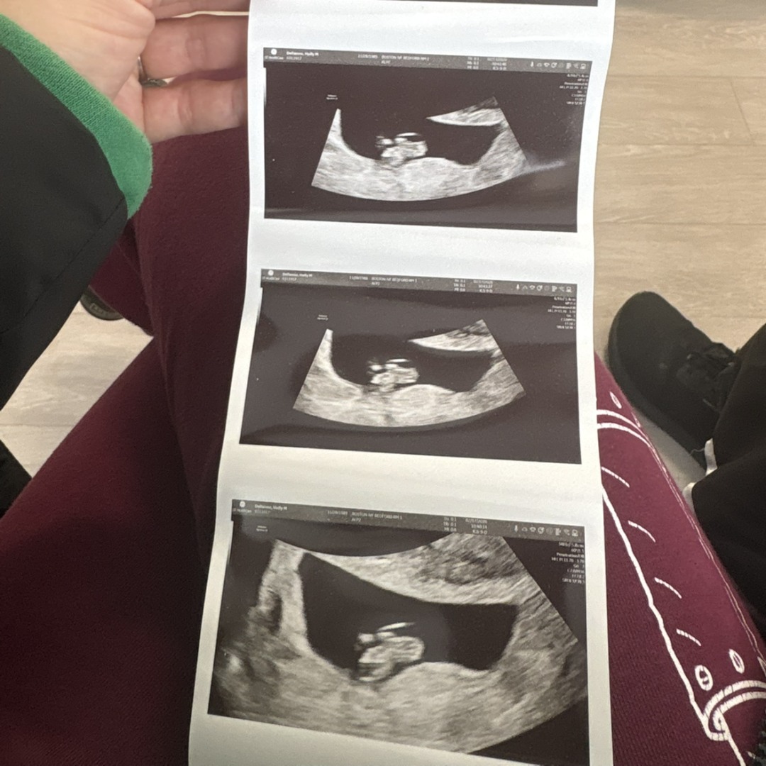 Photo shared by Holly for their Babylist baby registry.