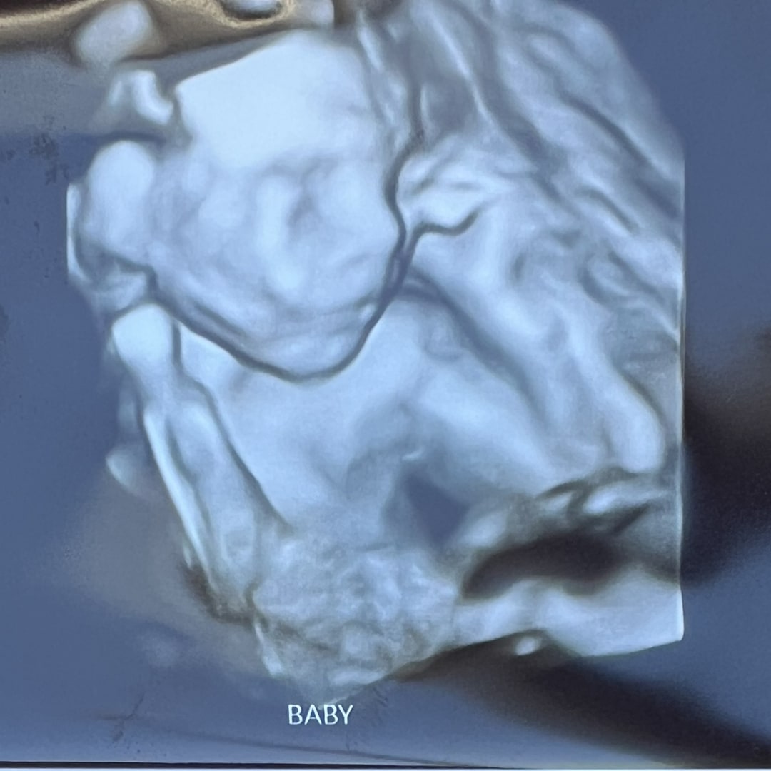 Photo shared by Catherine for their Babylist baby registry.