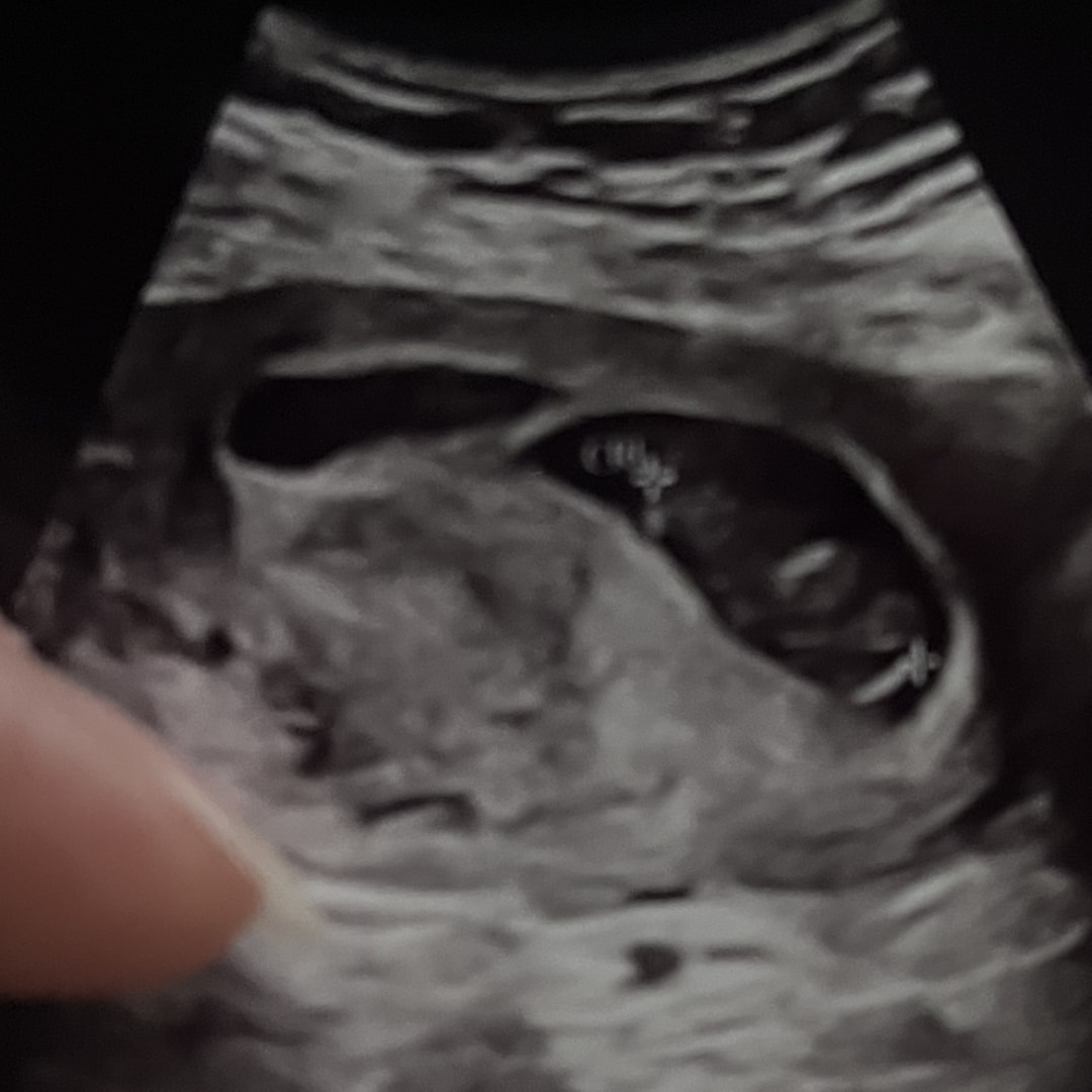 Photo shared by Carrie for their Babylist baby registry.