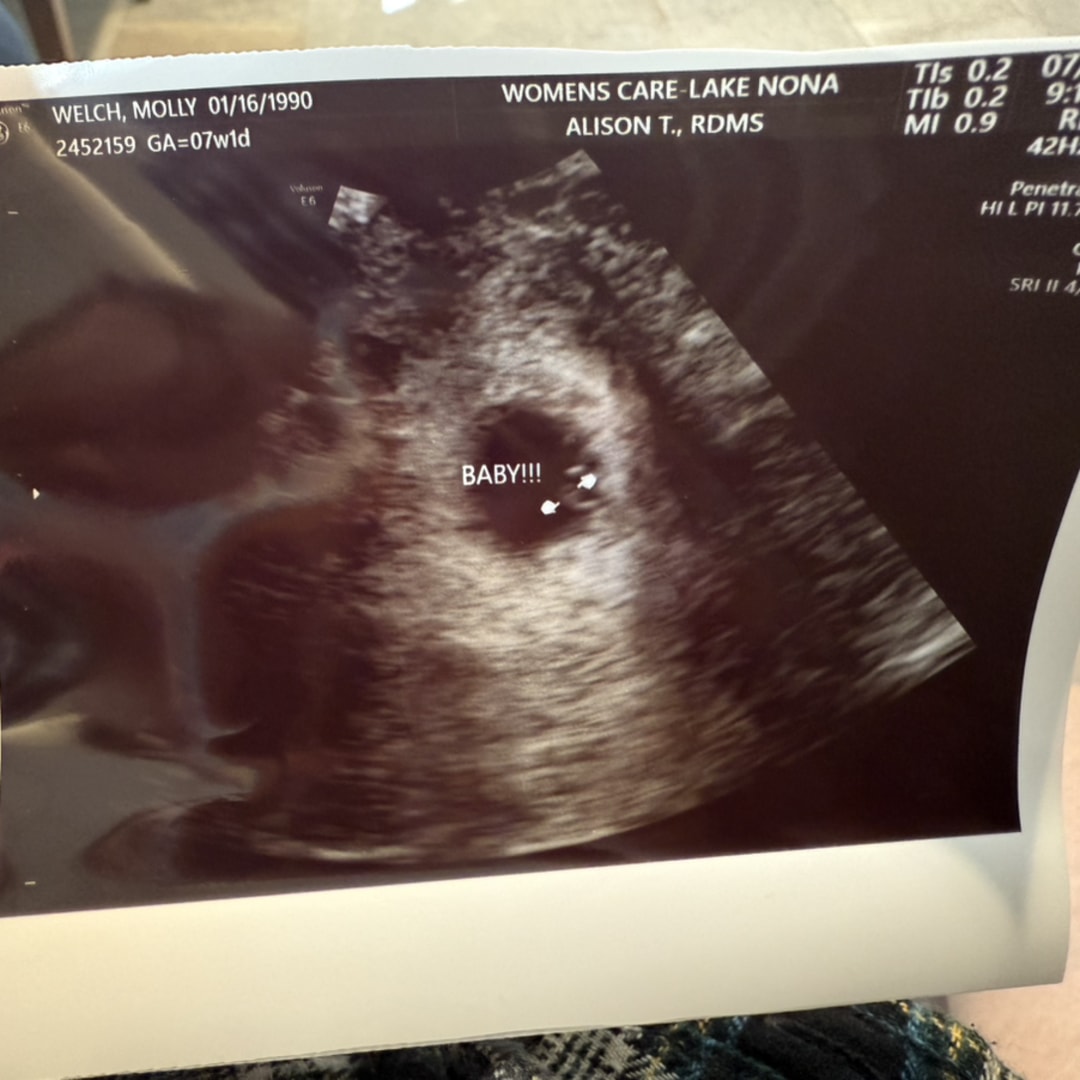 Photo shared by Molly for their Babylist baby registry.
