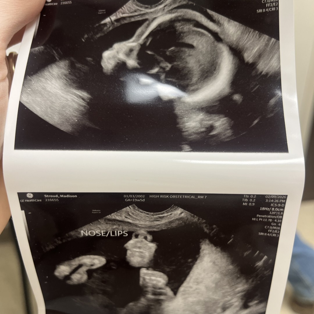 Photo shared by Madison for their Babylist baby registry.