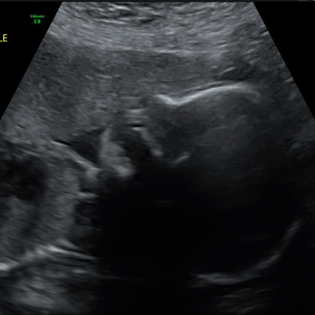 Photo shared by Natasha for their Babylist baby registry.