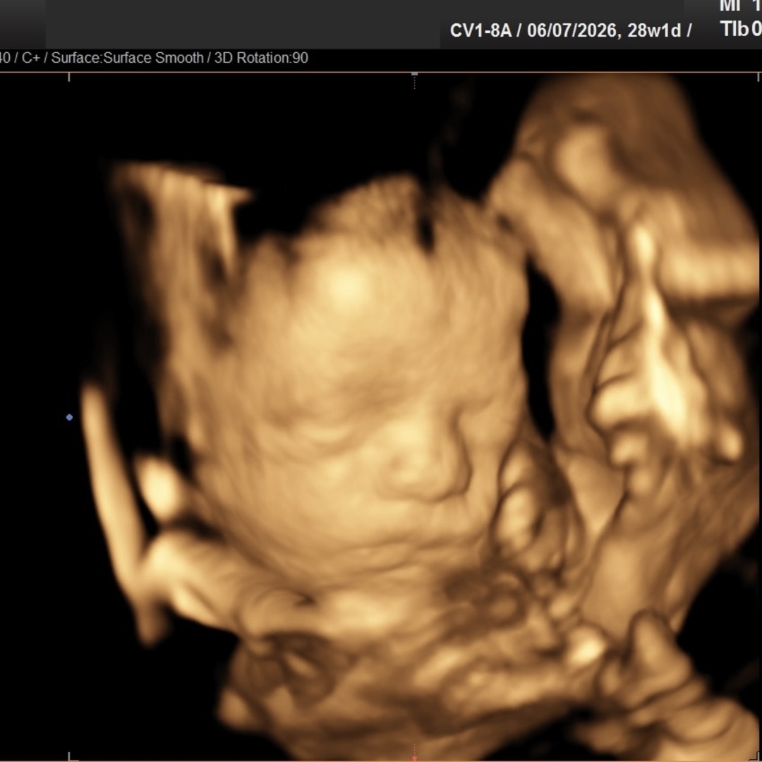 Photo shared by Ashlie for their Babylist baby registry.