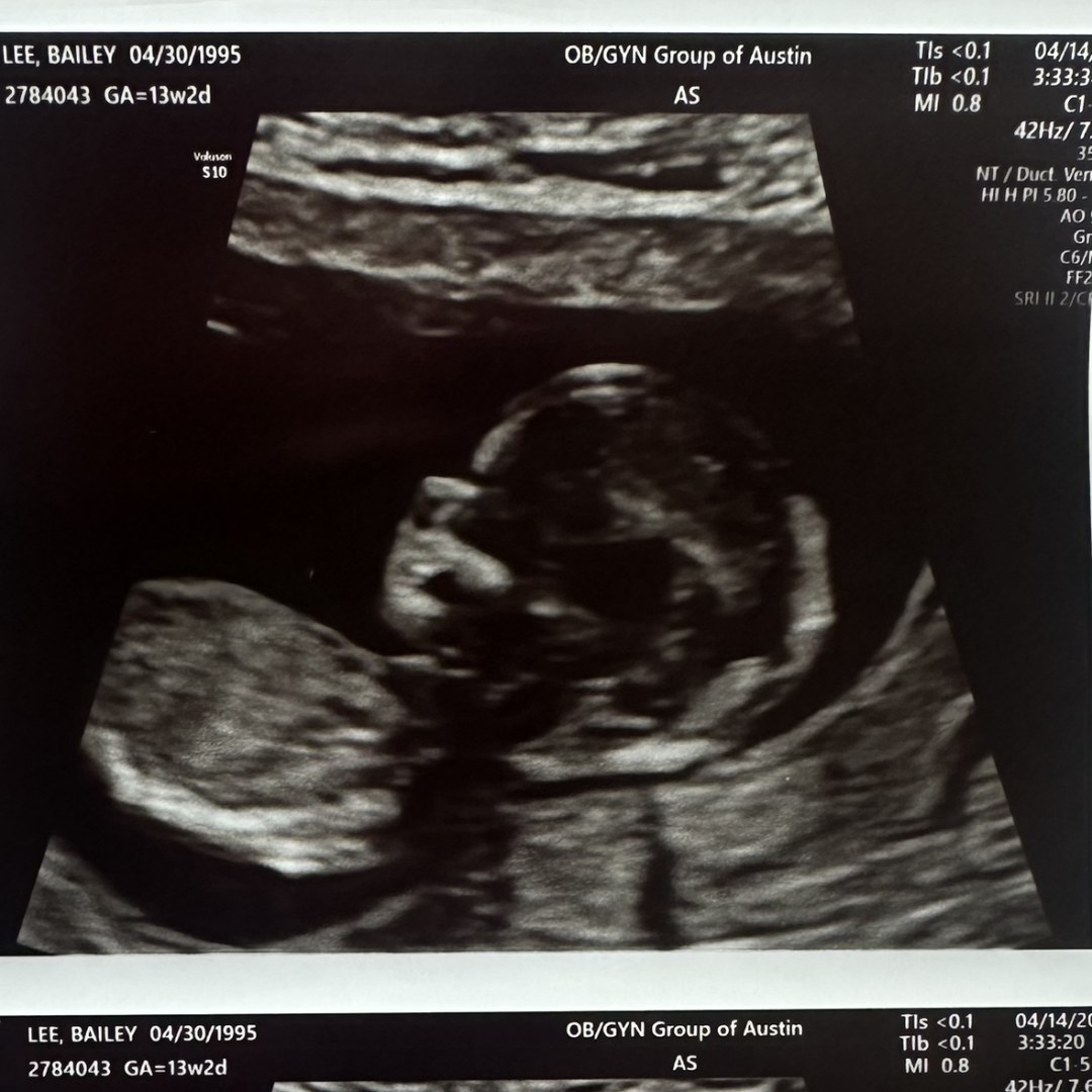 Photo shared by Bailey for their Babylist baby registry.