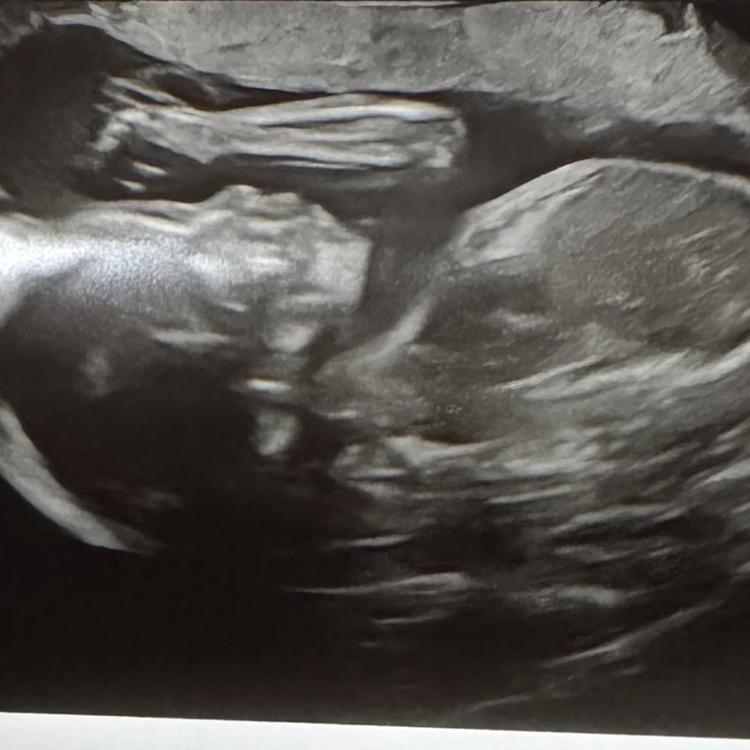 Photo shared by Ixcel for their Babylist baby registry.