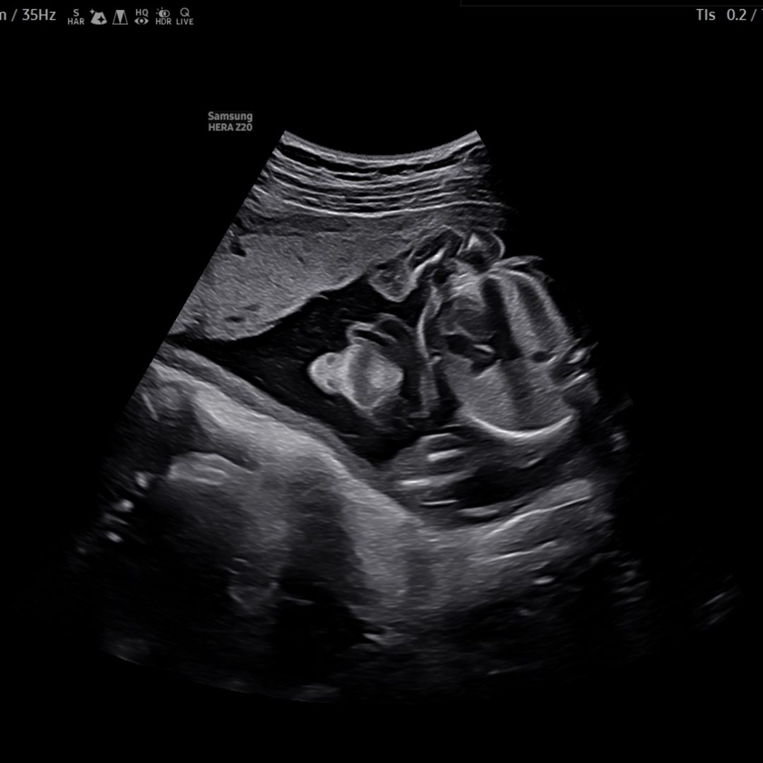 Photo shared by Catherine for their Babylist baby registry.