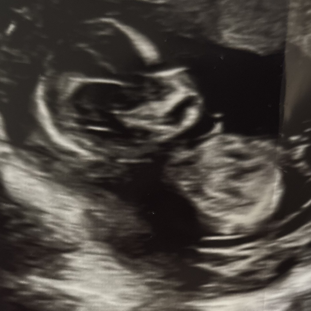 Photo shared by Jaleyda for their Babylist baby registry.